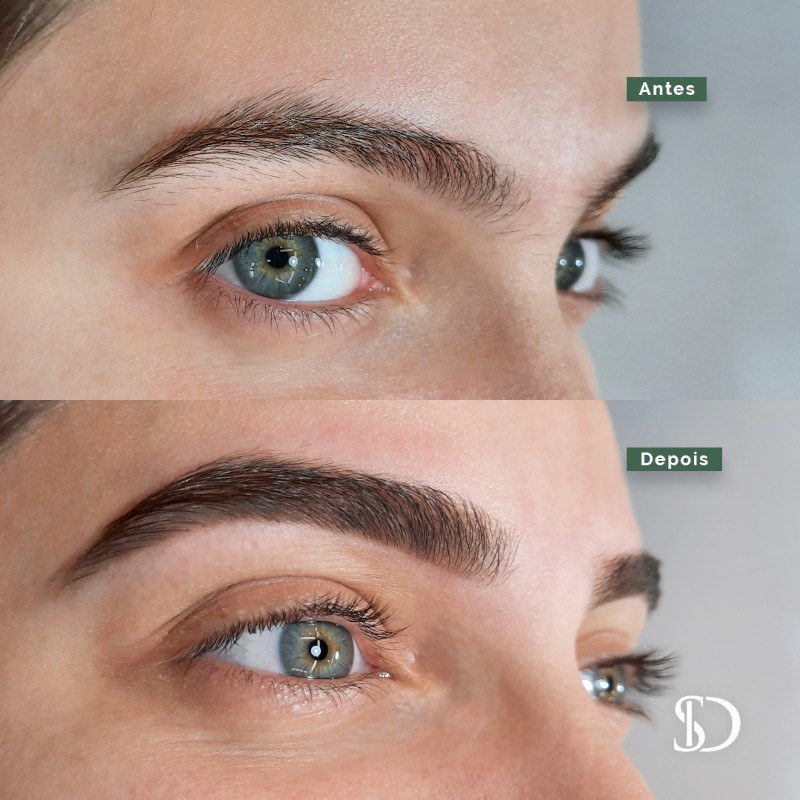 Antes e depois de um design de sobrancelhas